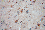GRP75 Antibody in Immunohistochemistry (Paraffin) (IHC (P))