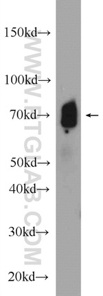 GRP75 Antibody in Western Blot (WB)