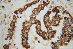 GRP75 Antibody in Immunohistochemistry (Paraffin) (IHC (P))