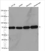 GRP75 Antibody in Western Blot (WB)