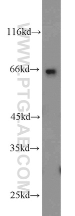 C1orf116 Antibody in Western Blot (WB)