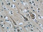ABI2 Antibody in Immunohistochemistry (Paraffin) (IHC (P))