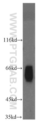 ABI2 Antibody in Western Blot (WB)