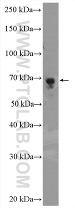 PCK2 Antibody in Western Blot (WB)