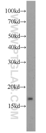 ATP5D Antibody in Western Blot (WB)