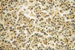 RPS10 Antibody in Immunohistochemistry (Paraffin) (IHC (P))