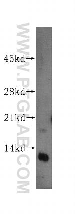 RBX1 Antibody in Western Blot (WB)