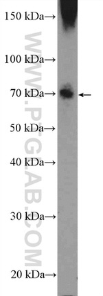 HKR1 Antibody in Western Blot (WB)