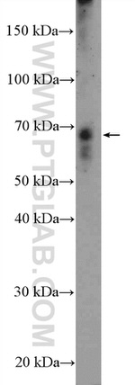 HKR1 Antibody in Western Blot (WB)