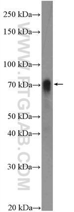 HKR1 Antibody in Western Blot (WB)