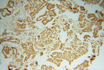 PSMC2 Antibody in Immunohistochemistry (Paraffin) (IHC (P))
