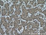 PSMC2 Antibody in Immunohistochemistry (Paraffin) (IHC (P))