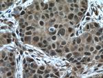 PSMC2 Antibody in Immunohistochemistry (Paraffin) (IHC (P))