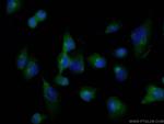 FADD Antibody in Immunocytochemistry (ICC/IF)