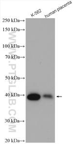 SERPINB9 Antibody in Western Blot (WB)