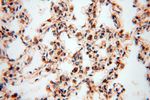 NDUFB7 Antibody in Immunohistochemistry (Paraffin) (IHC (P))