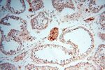 NDUFB7 Antibody in Immunohistochemistry (Paraffin) (IHC (P))