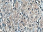 UROS Antibody in Immunohistochemistry (Paraffin) (IHC (P))