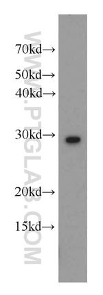 UROS Antibody in Western Blot (WB)