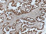HN1 Antibody in Immunohistochemistry (Paraffin) (IHC (P))