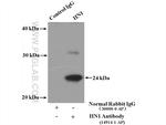 HN1 Antibody in Immunoprecipitation (IP)
