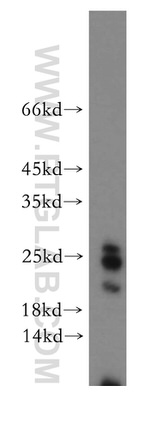 HN1 Antibody in Western Blot (WB)