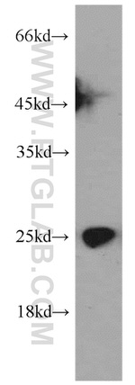 HN1 Antibody in Western Blot (WB)
