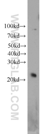 HN1 Antibody in Western Blot (WB)