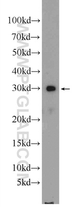 HN1 Antibody in Western Blot (WB)