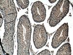 DDOST Antibody in Immunohistochemistry (Paraffin) (IHC (P))