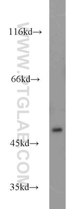 DDOST Antibody in Western Blot (WB)