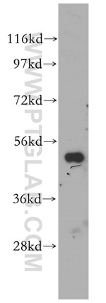 DDOST Antibody in Western Blot (WB)