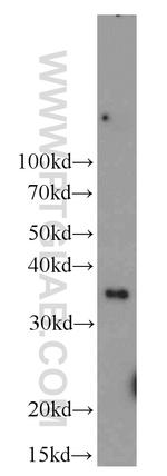 NTHL1 Antibody in Western Blot (WB)