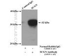SCGN Antibody in Immunoprecipitation (IP)