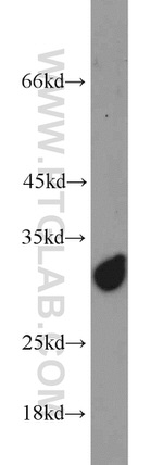 SCGN Antibody in Western Blot (WB)