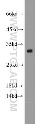 SCGN Antibody in Western Blot (WB)