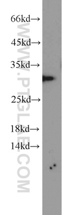 SCGN Antibody in Western Blot (WB)