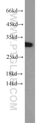 SCGN Antibody in Western Blot (WB)