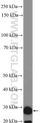 SCGN Antibody in Western Blot (WB)