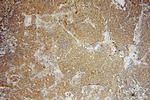 ATP6V1D Antibody in Immunohistochemistry (Paraffin) (IHC (P))