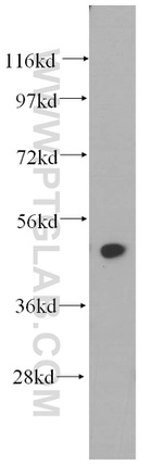 THUMPD1 Antibody in Western Blot (WB)