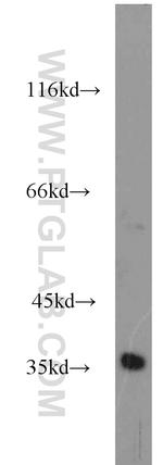 SUCLG1 Antibody in Western Blot (WB)