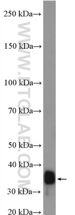 SUCLG1 Antibody in Western Blot (WB)