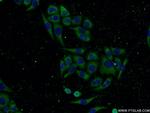 CNDP2 Antibody in Immunocytochemistry (ICC/IF)