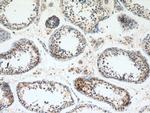 CNDP2 Antibody in Immunohistochemistry (Paraffin) (IHC (P))