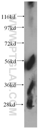 CNDP2 Antibody in Western Blot (WB)