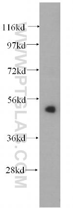 CNDP2 Antibody in Western Blot (WB)