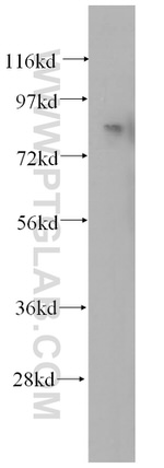 ANAPC5 Antibody in Western Blot (WB)