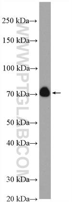 ANAPC5 Antibody in Western Blot (WB)