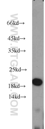 TIM22 Antibody in Western Blot (WB)